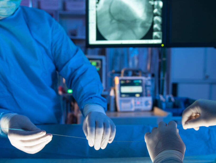 Close up of the hands with stent